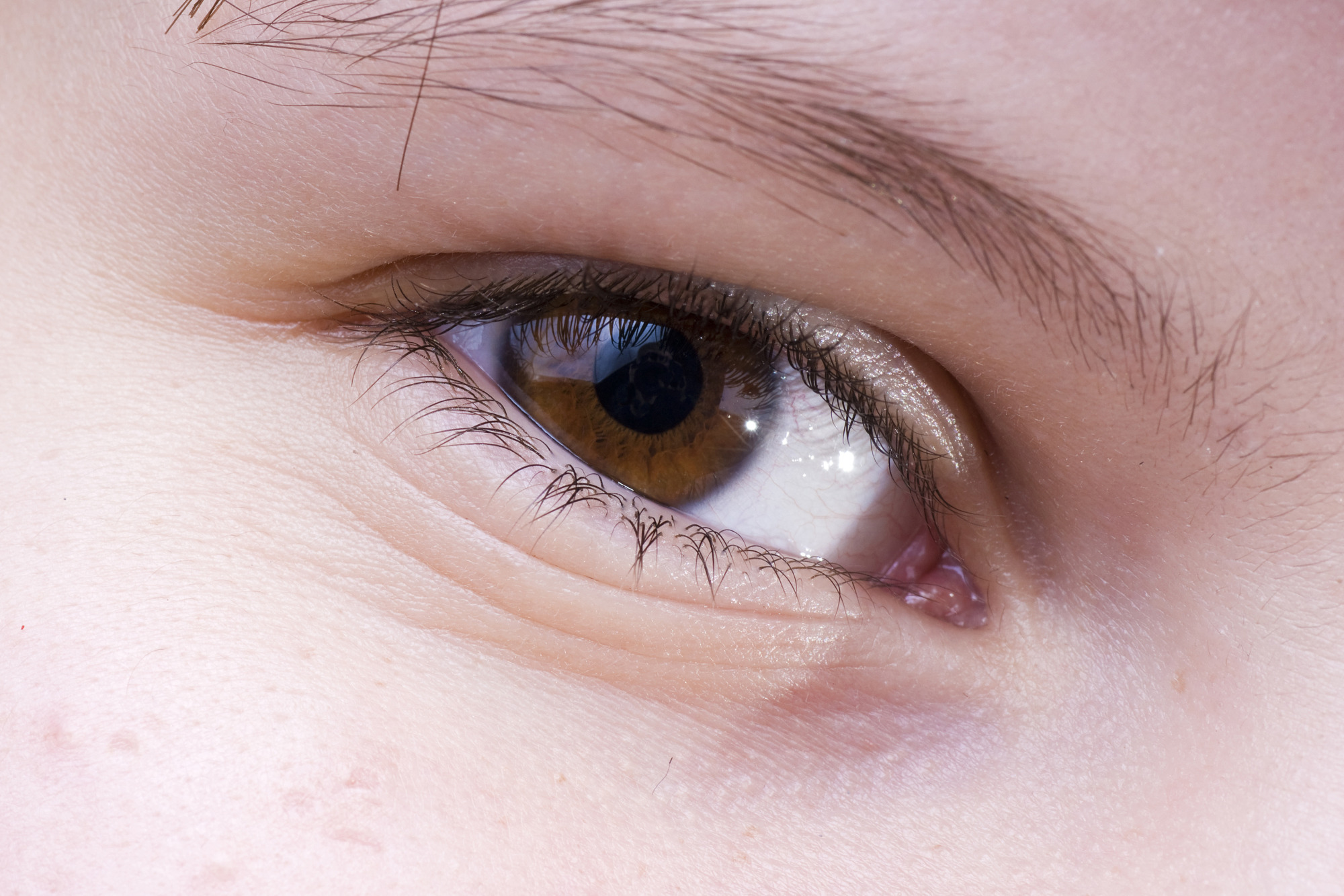 5 Tips to Prevent Dry Eye This Winter