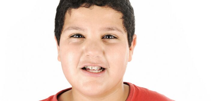 Tips for Choosing the Right Orthodontist