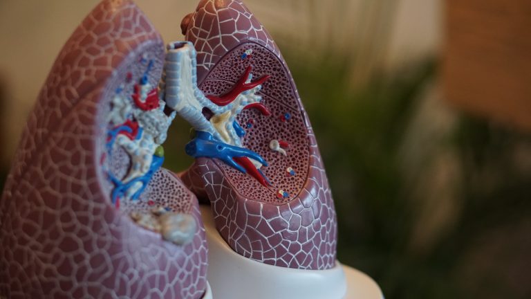Why Early Detection of Lung Cancer is So Important