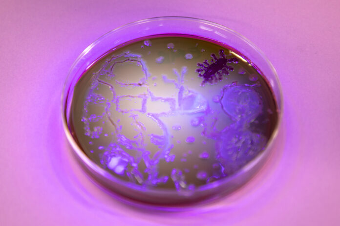 Shanequa Blount_Agar Art 2